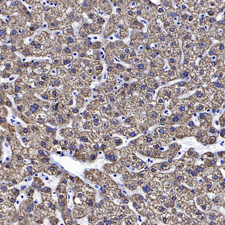 Hepatocyte Specific Antigen Recombinant Mouse mAb (SDT-4389)