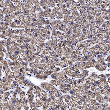 Hepatocyte Specific Antigen Recombinant Mouse mAb (SDT-4389)