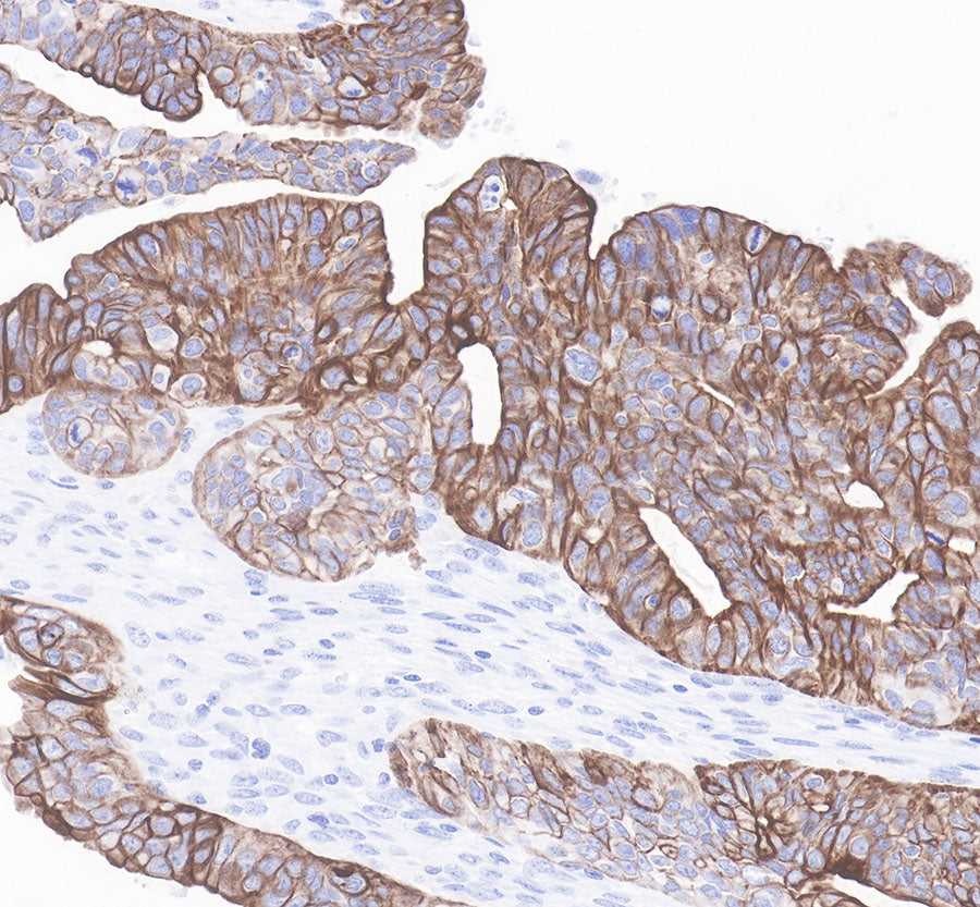 S-RMab® Cytokeratin 7 Recombinant Rabbit  mAb,PBS Only (SDT-121-17)