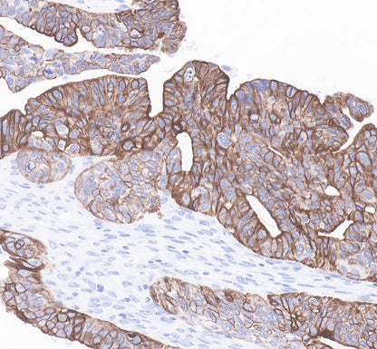 S-RMab® Cytokeratin 7 Recombinant Rabbit  mAb,PBS Only (SDT-121-17)