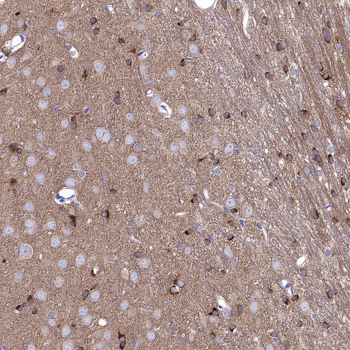 GAD65 Recombinant Rabbit mAb (S-2318-47)
