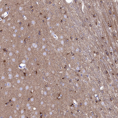 GAD65 Recombinant Rabbit mAb (S-2318-47)
