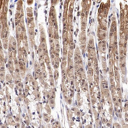 ASC/TMS1 Rabbit Polyclonal Antibody