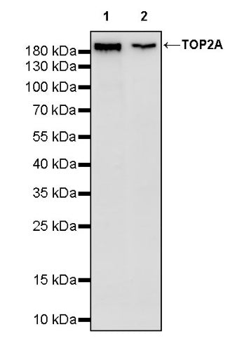TOP2A Recombinant Rabbit mAb (S-513-107)