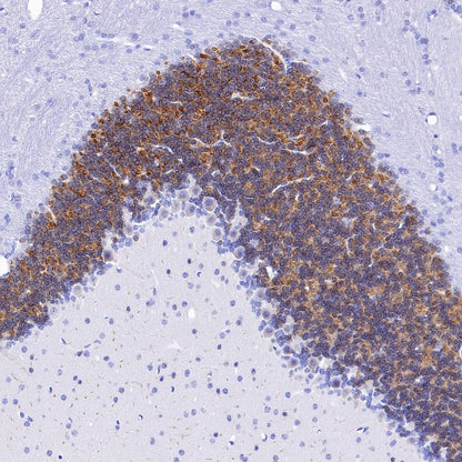 GABRD Recombinant Rabbit mAb (S-1584-162)