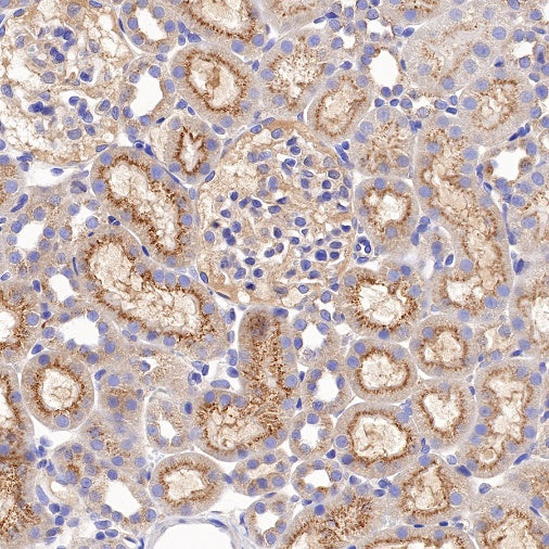 VPS35 Recombinant Rabbit mAb (S-997-2)
