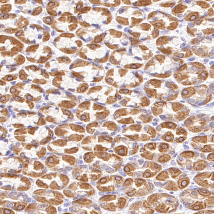 CDS1 Recombinant Rabbit mAb (S-3671-30)
