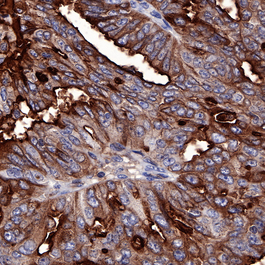 S-RMab® Mesothelin Recombinant Rabbit mAb (SDT-R070)