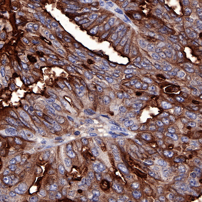 S-RMab® Mesothelin Recombinant Rabbit mAb (SDT-R070)