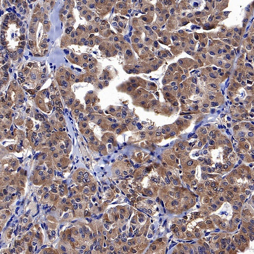 Park7/DJ-1 Recombinant Rabbit mAb (S-980-144)
