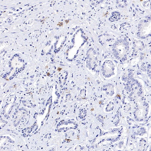 FCER1A/FcεRIα Recombinant Rabbit mAb (S-1697-174)