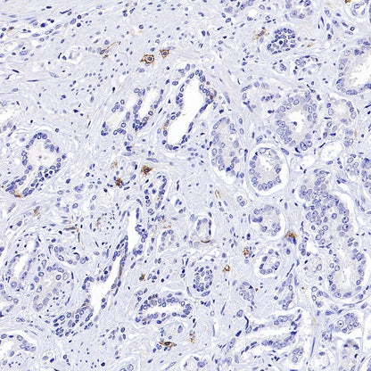 FCER1A/FcεRIα Recombinant Rabbit mAb (S-1697-174)