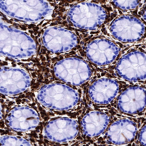 Vimentin Recombinant Rabbit mAb (SDT-029-120)
