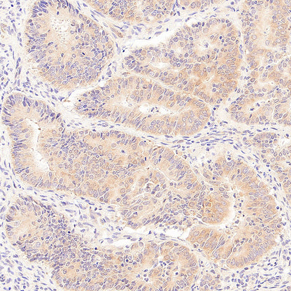 PHD1/prolyl hydroxylase Recombinant Rabbit mAb (S-5060-43)
