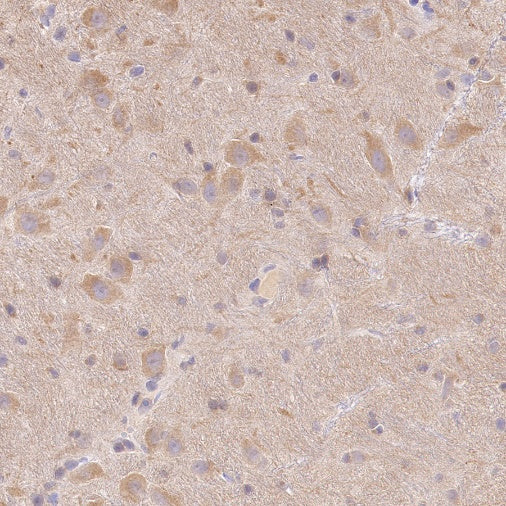 LC3A/B Recombinant Rabbit mAb (S-1367-104)
