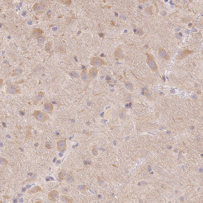 LC3A/B Recombinant Rabbit mAb (S-1367-104)