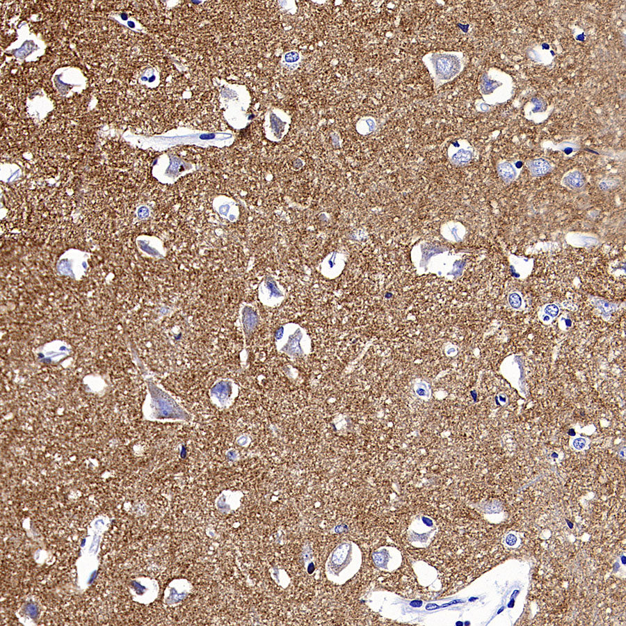 SV2A Recombinant Rabbit mAb (S-4049-16)