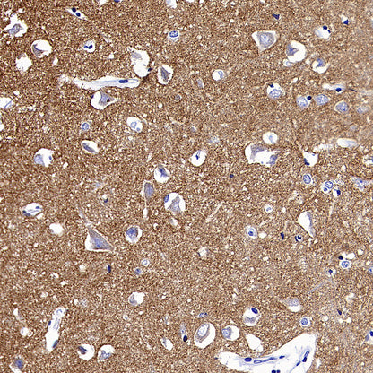 SV2A Recombinant Rabbit mAb (S-4049-16)