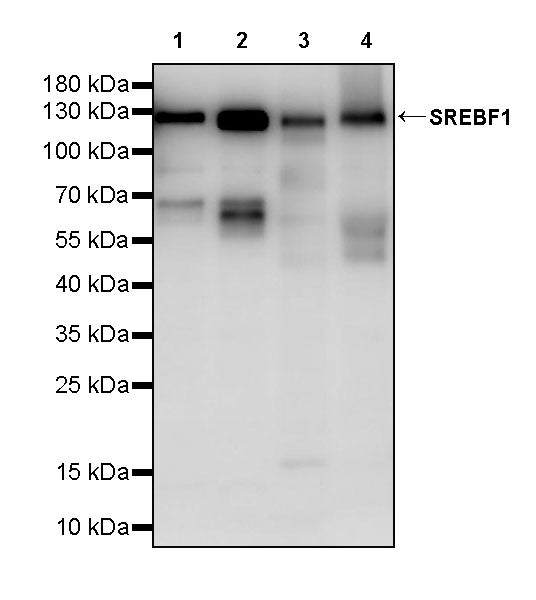 SREBF1 Recombinant Rabbit mAb (S-4175-21)