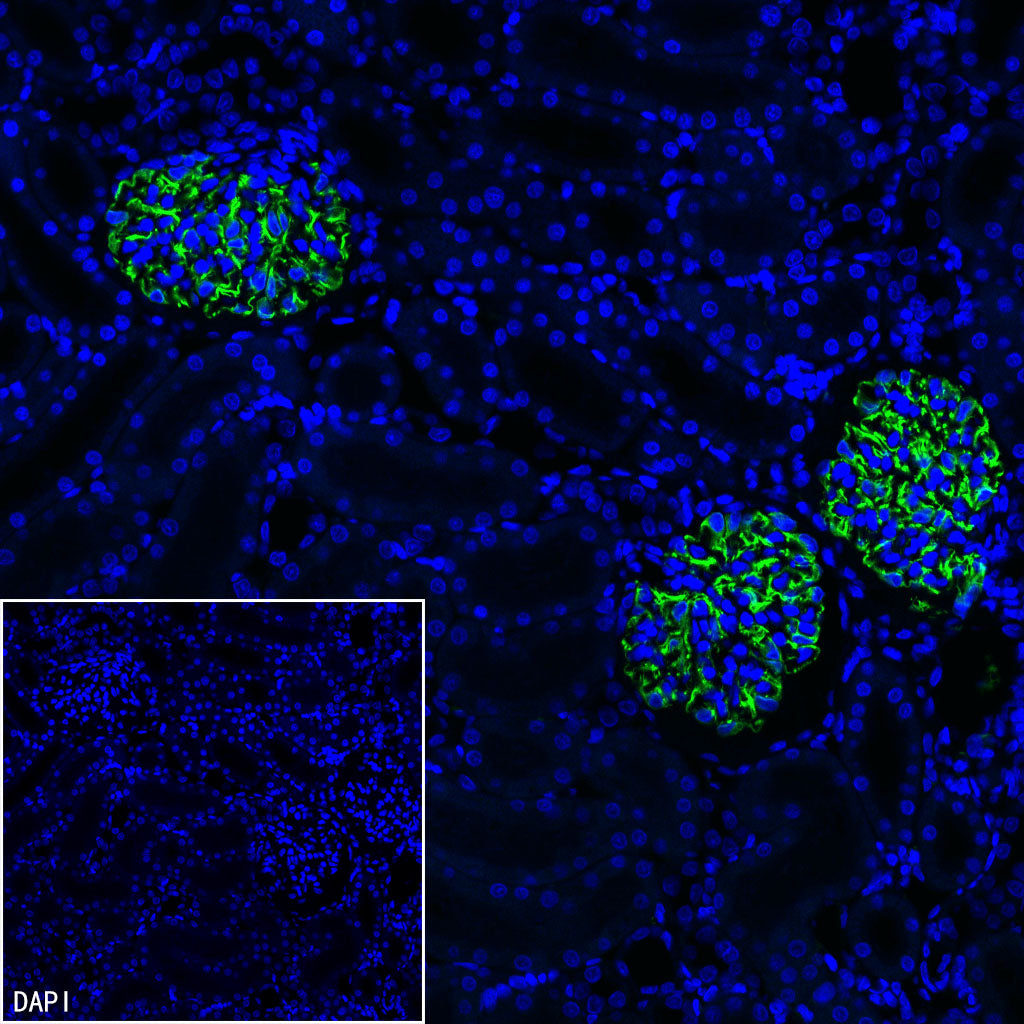 Nestin Recombinant Rabbit mAb (S-3890-112)
