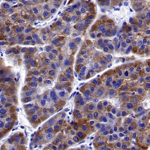 ACSL1 Recombinant Rabbit mAb (S-811-150)