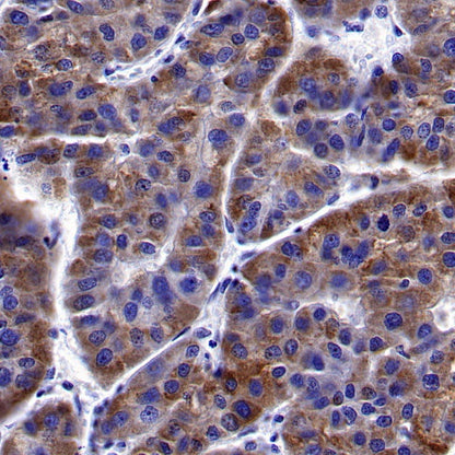 ACSL1 Recombinant Rabbit mAb (S-811-150)