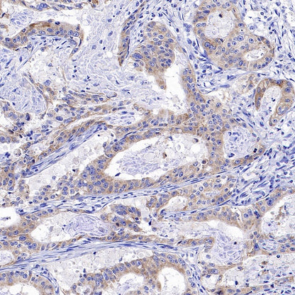 FUNDC1 Rabbit Polyclonal Antibody