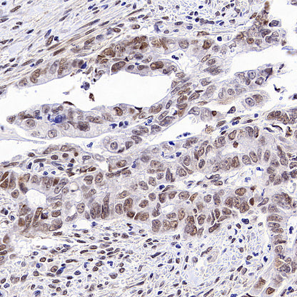 SMARCA3 Recombinant Rabbit mAb (S-3575-154)