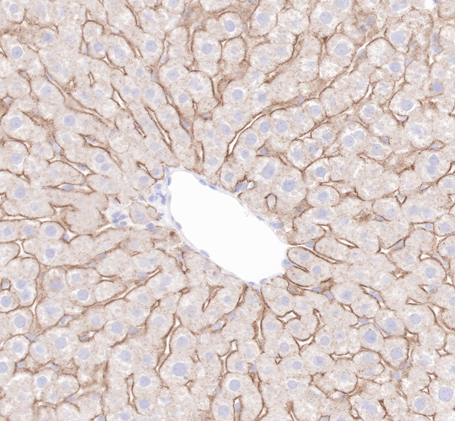 LDL receptor Recombinant Rabbit  mAb (SDT-057-57)