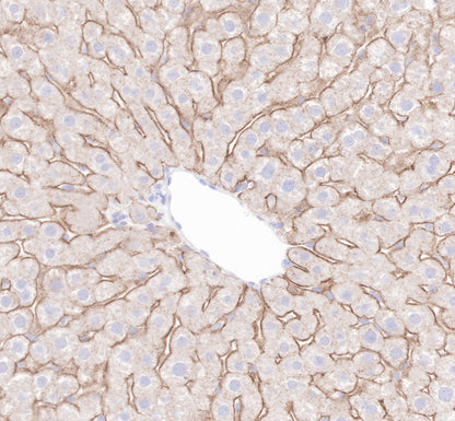 LDL receptor Recombinant Rabbit  mAb (SDT-057-57)