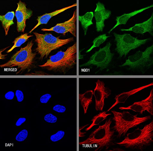 NQO1 Recombinant Rabbit mAb (S-1672-2)