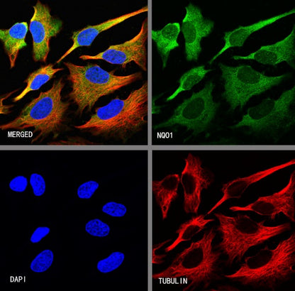 NQO1 Recombinant Rabbit mAb (S-1672-2)