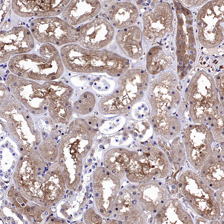 4E-BP1 Recombinant Rabbit mAb (S-4103-65)