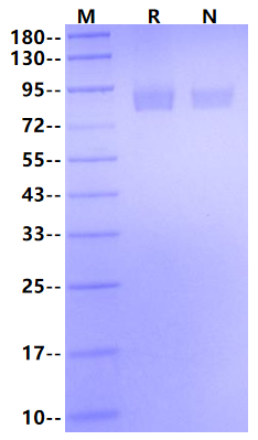 Biotinylated MMP-9 His&Avi Tag Protein, Human