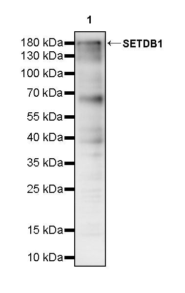 SETDB1 Recombinant Rabbit mAb (S-4094-31)