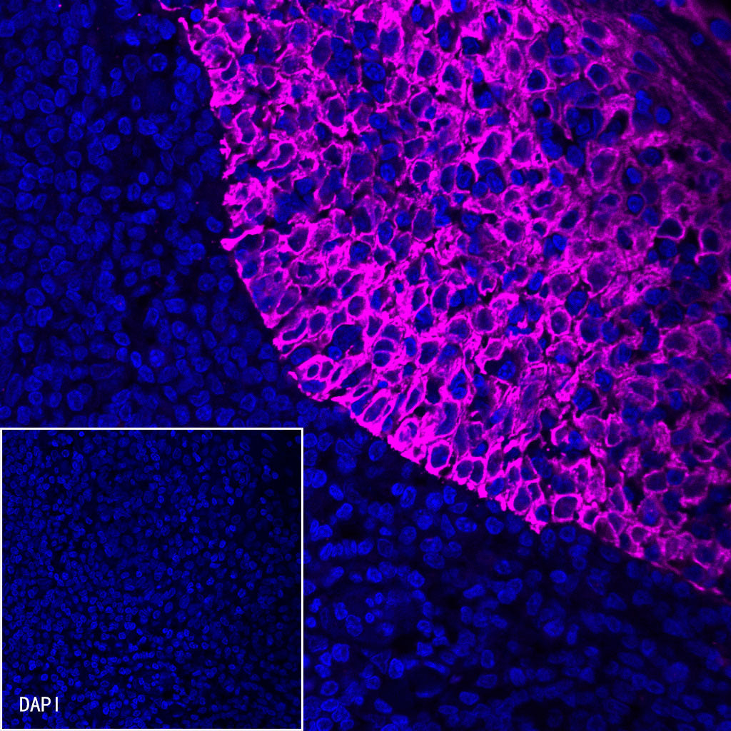 S-RMab® CK5/6 Recombinant Rabbit mAb,PBS Only (SDT-P004)