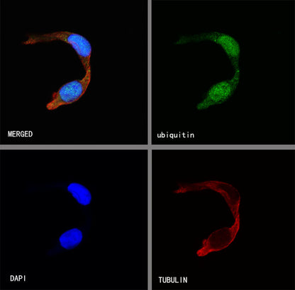 Ubiquitin Rabbit mAb (SDT-R095)