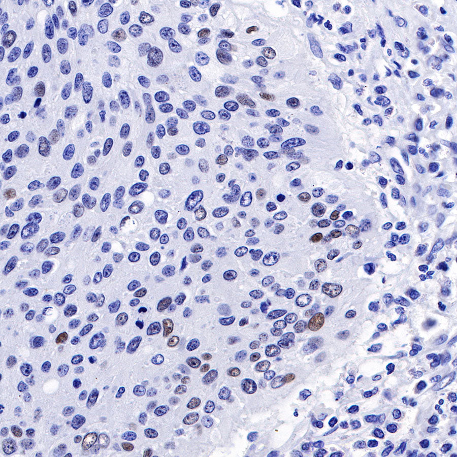 S-RMab® p53 Recombinant Rabbit mAb (SDT-R118)