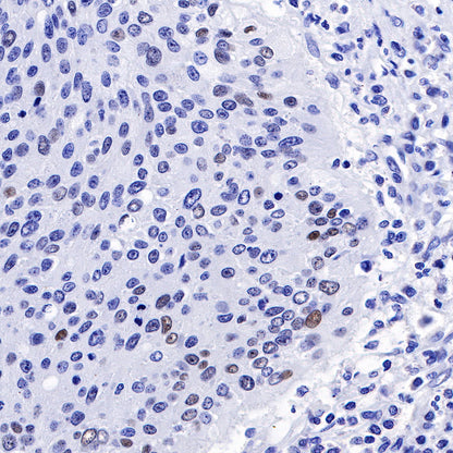 S-RMab® p53 Recombinant Rabbit mAb (SDT-R118)