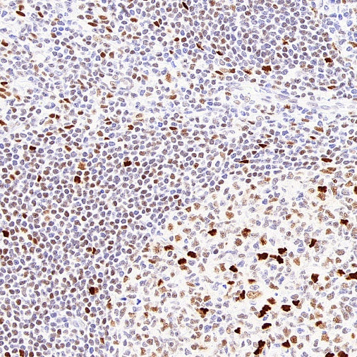 FOXP4 Recombinant Rabbit mAb (S-6198)