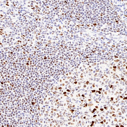 FOXP4 Recombinant Rabbit mAb (S-6198)