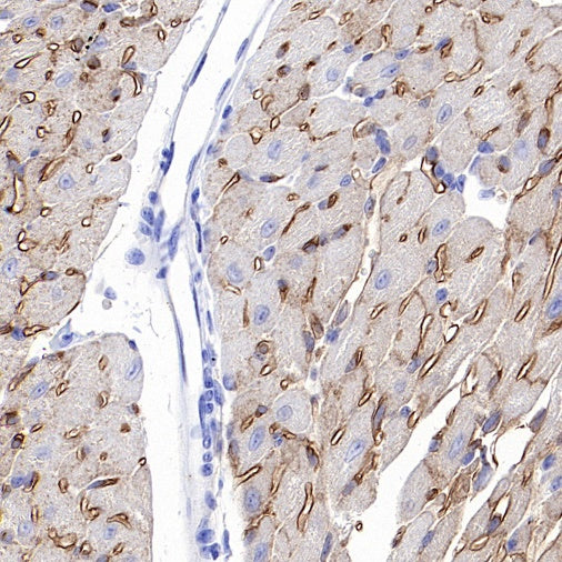 CD36 Recombinant Rabbit mAb (S-1028-127)
