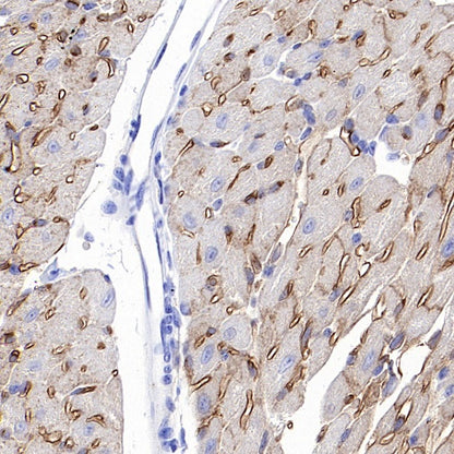 CD36 Recombinant Rabbit mAb (S-1028-127)