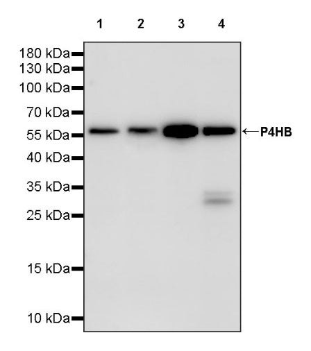 P4HB Recombinant Rabbit mAb (S-1524-120)