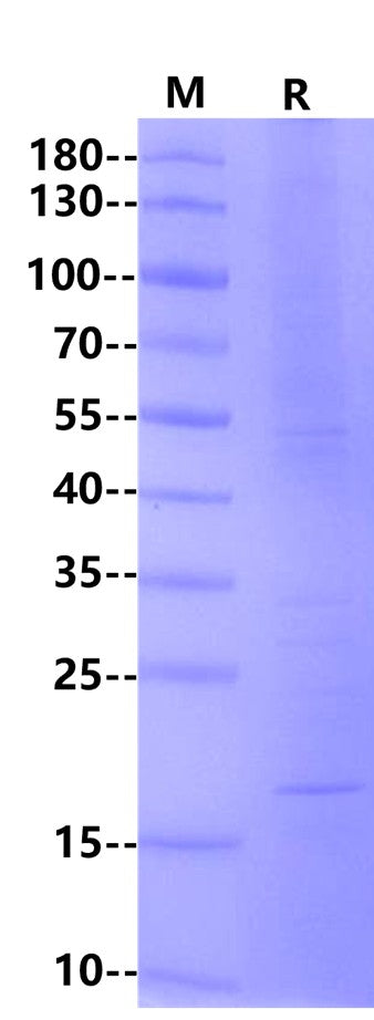Claudin 18.2 His Tag Protein, Human