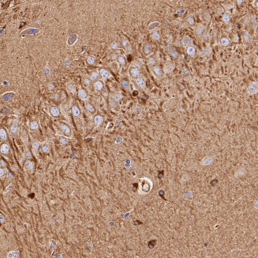 Beta IV Tubulin Recombinant Rabbit mAb (S-1572-30)