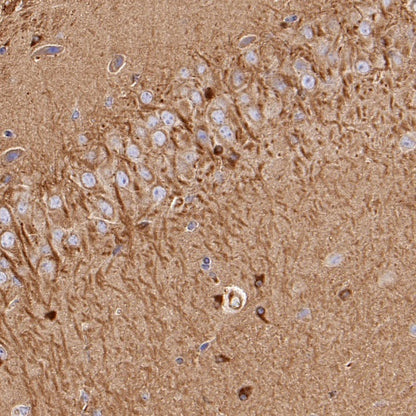 Beta IV Tubulin Recombinant Rabbit mAb (S-1572-30)