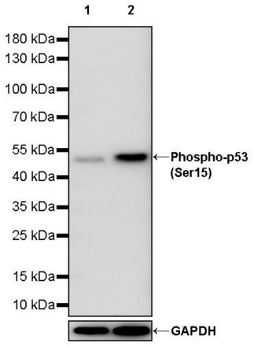 Phospho-p53 (Ser15) Rabbit Polyclonal Antibody