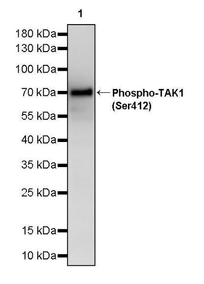 Phospho-TAK1 (Ser412) Recombinant Rabbit mAb (S-3334-138)