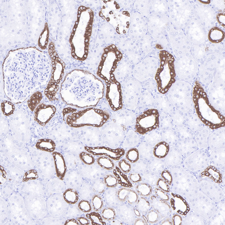 S-RMab® CK-Pan Recombinant Rabbit mAb (SDT-P001)